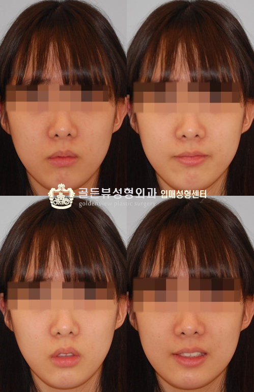 사람 인상에서 은근히 많이 차지하는거 | 인스티즈