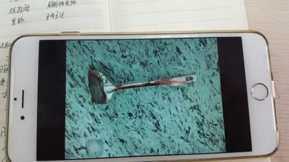 뒤집개를 삼켜서 죽을뻔한 여성 (혐오주의) | 인스티즈