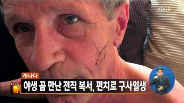 곰의 습격을 받은 할아버지.jpg | 인스티즈