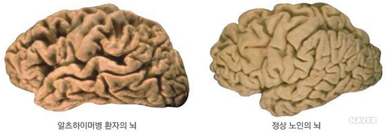 세상에서 둘 중 한가지만 사라지게 할 수 있다면? | 인스티즈