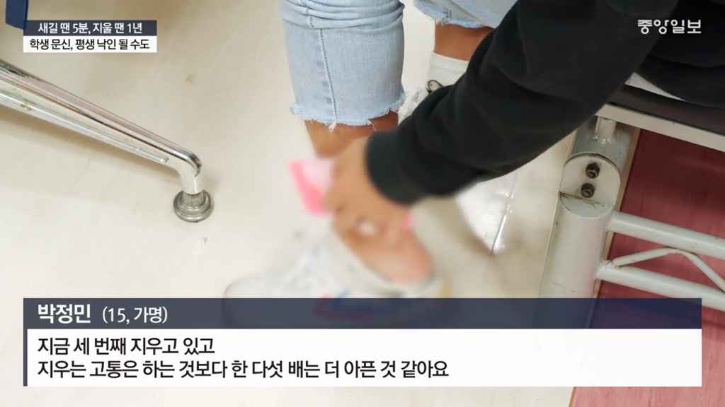 문신하고 후회하는 10대들 | 인스티즈