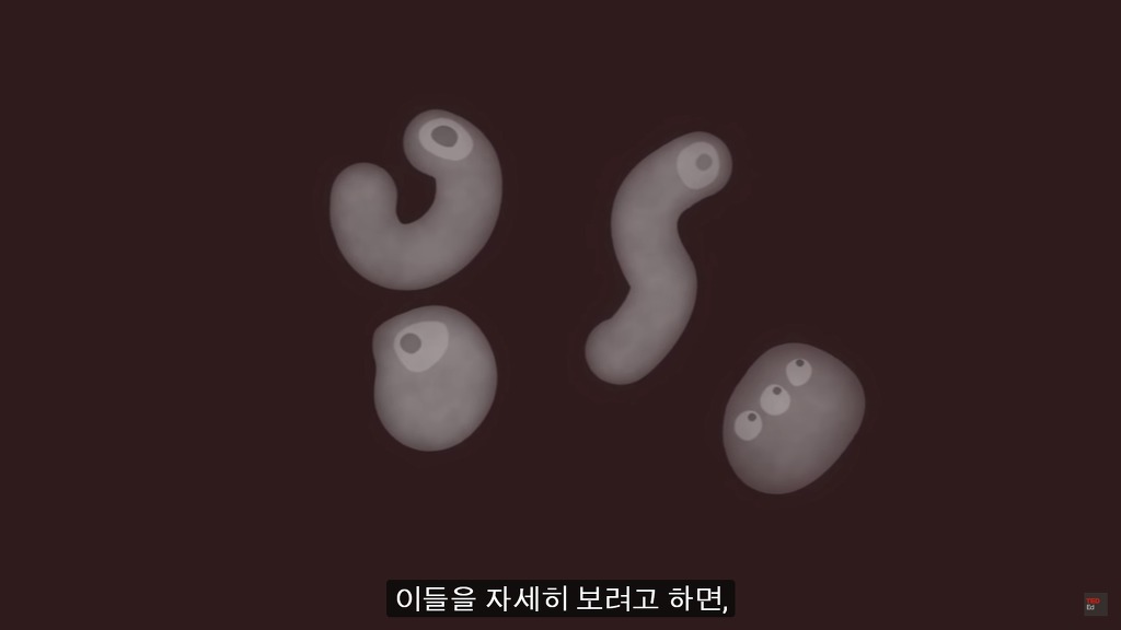 여러분의 눈에 둥둥 떠다니는 그것들은 무엇일까요? | 인스티즈