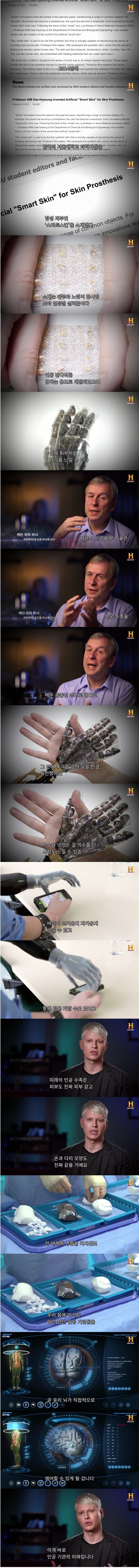 서울대에서 개발한 인공피부 | 인스티즈