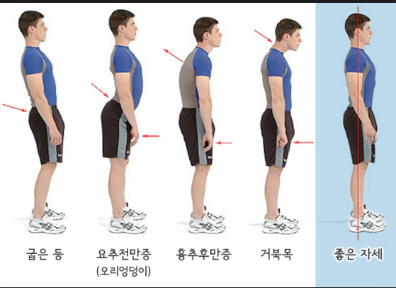 어렸을 때 관리 안 해서 제일 후회하는 것은?..jpg | 인스티즈